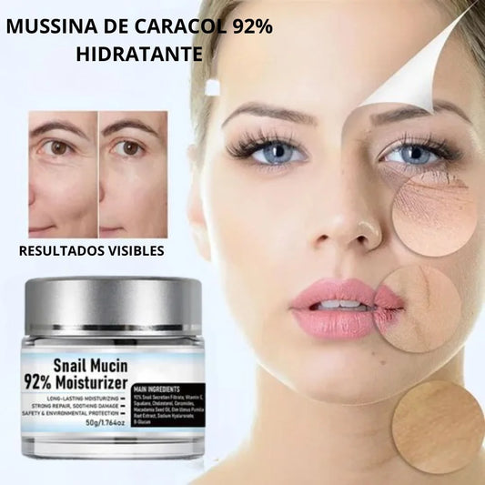 BABA CARACOL AL 92% - HIDRATA Y REPARA